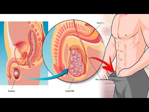 Tabletten für den Preis der Prostata Behandlung von kongestiver Prostatitis Bewertungen