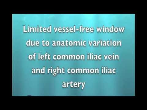 11. Tips and tricks on how to avoid injury during laparoscopic sacrocolpopexy/hysteropexy