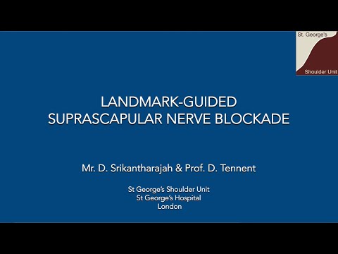 Suprascapular Nerve Block Landmark Technique