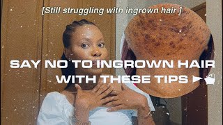 How to get rid of ingrown hair as a black woman + Tips and hacks .