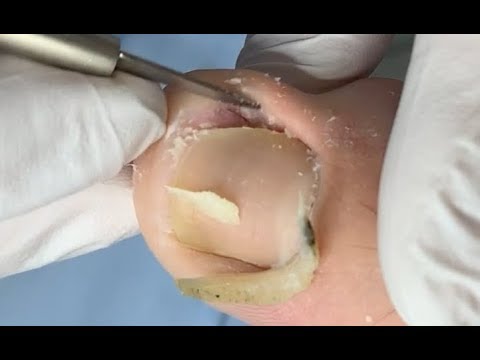 download lagu mp3 mp4 Dirty Nails, download lagu Dirty Nails gratis, unduh video klip Dirty Nails