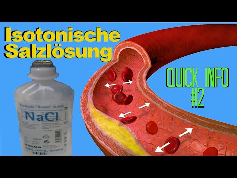 Schädel Hypertonie-Behandlung Hypertensive Herzkrankheit Beschwerden
