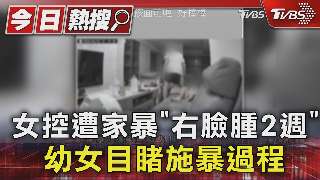 女控遭家暴「右臉腫2週」 幼女目睹施暴過程  網友肉搜小吃店成出氣包｜TVBS新聞 @TVBSNEWS01