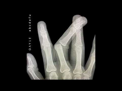 Gayle vs Eric Prydz - ABCDEFU vs Pjanoo (Djs From Mars x Rudeejay & Da Brozz Bootleg) REVERB EDIT