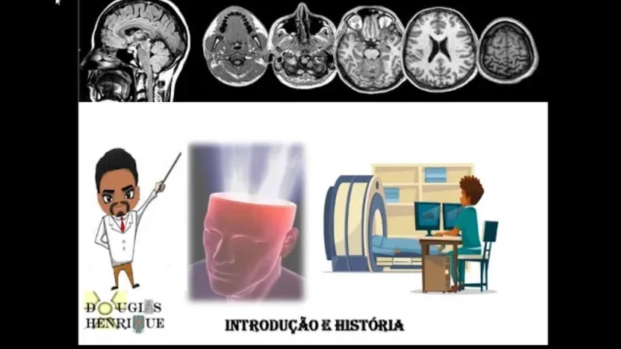 RESSONÂNCIA MAGNÉTICA | AULA 1|INTRODUÇÃO E HISTÓRIA
