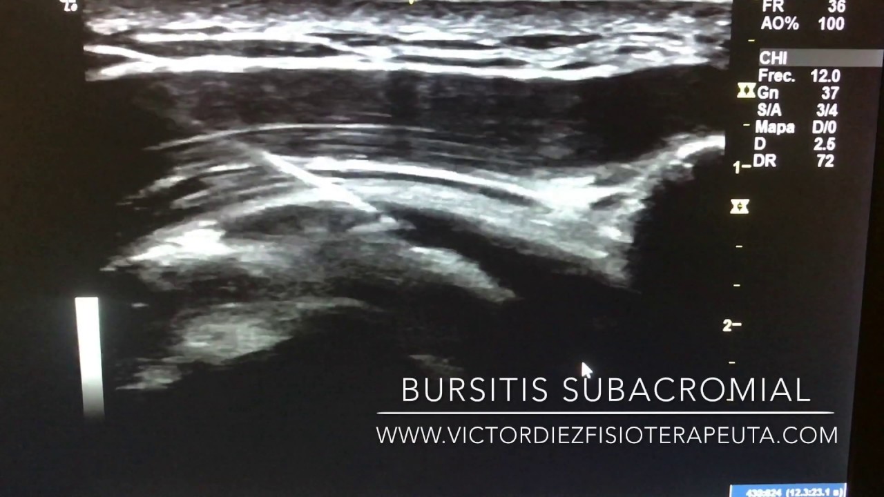 Víctor Díez Alvarez-13