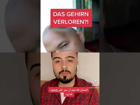 انسان که نیم از سر اش‌ وجود ندارد اما هنوز هم زنده است .