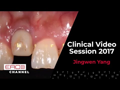 Jingwen Yang / Clinical Video Session 2017
