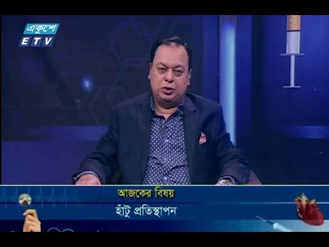 দি ডক্টরস || ০৮ নভেম্বর ২০১৮ || বিষয় : হাঁটু প্রতিস্থাপন || উপস্থাপনা : অধ্যাপক ডা. ইকবাল হাসান মাহমুদ আলোচক : ডা. পারভেজ আহসান (সহযোগী অধ্যাপক, অর্থোপেডিক সার্জারী বিভাগ, ইবনে সিনা মেডিকেল কলেজ, ঢাকা)।