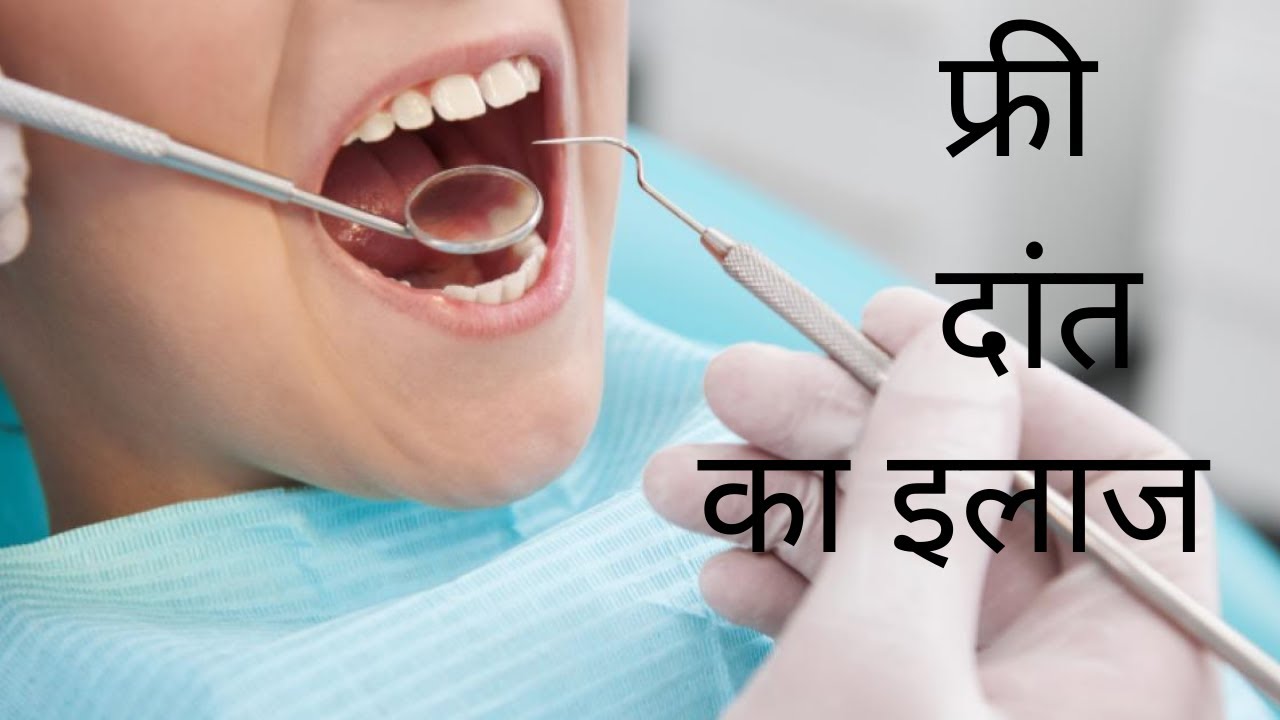 फ्री दांत का इलाज Free Dental Treatment in Rohini, Delhi cheap dental RCT, Implant, Cap, Bridge
