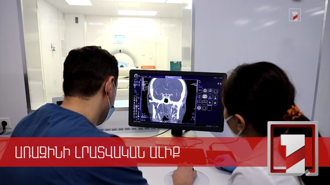 Իշեմիկ կաթվածը շուտով հնարավոր կլինի անվճար բուժել նաև Գյումրիում