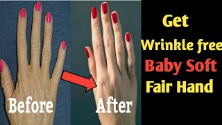 Remove Wrinkles Form Hands! Make Your Hands Look 10 year Younger! Get Baby Soft Fair Hand #short