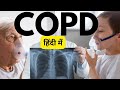 COPD Symptoms Treatment COPD In Hindi COPD Kya Hai COPD In Hindi