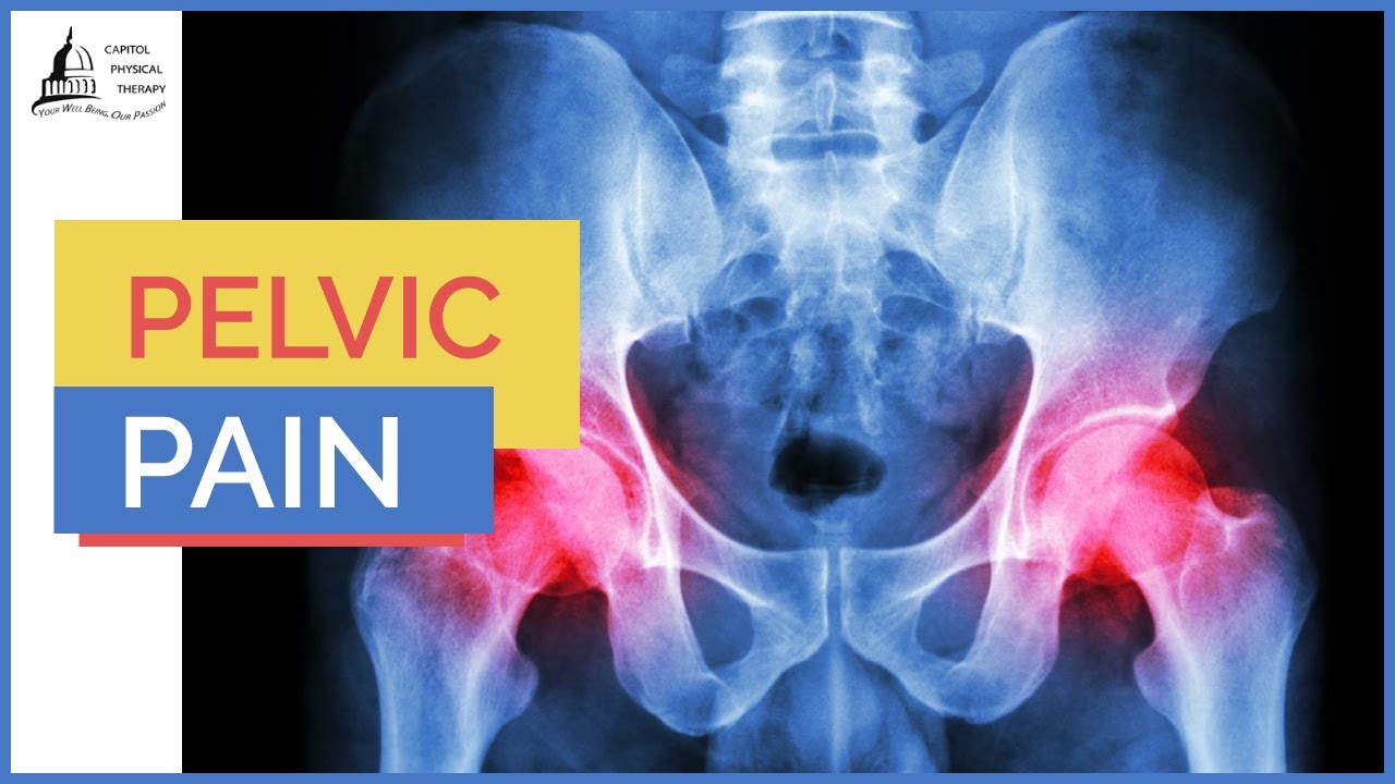 How Physical Therapy Can Help Treat Pelvic Pain | Capitol Physical Therapy | Washington DC PT
