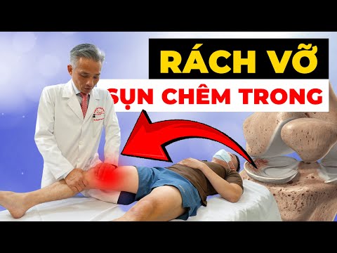 Đầu Gối Kêu Lục Cục, Đau Nhói Không Dám Đi - Cảnh Báo Sụn Chêm Đã Rách
