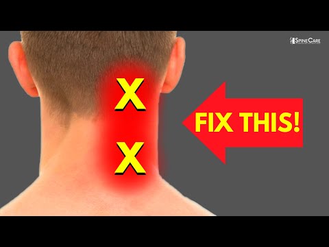 How to Fix Neck Pain off to the Side