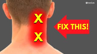 How to Fix Neck Pain off to the Side