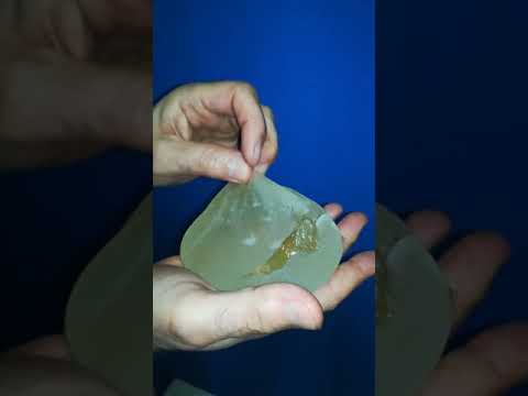 Sadržaj MENTOR implantata