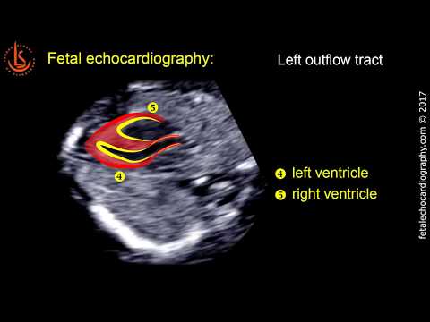 Fetale Echokardiographie bei 11-13 Wochen: Technik des frühen Herzscans