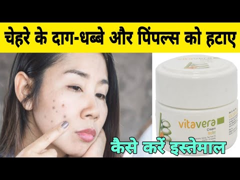 Vitavera Cream Review in Hindi | Benefits of Vitavera Cream | How to use Vitavera Cream