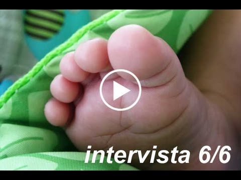 Come mal di gambe dopo lintervento chirurgico dellarticolazione del ginocchio Come aiutare le articolazioni