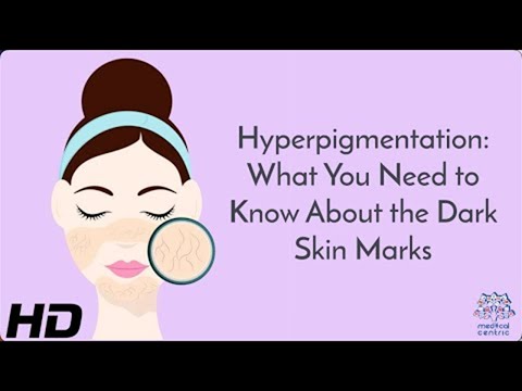 All About Allergy Shots