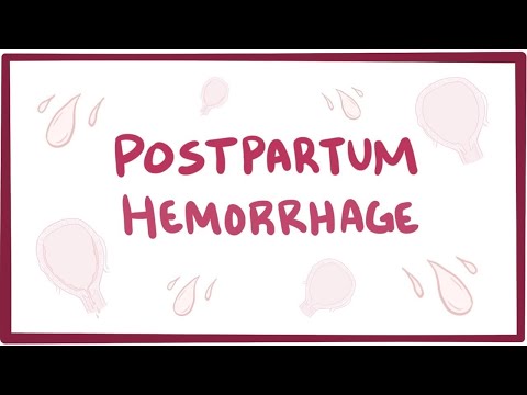 Postpartum hemorrhage - causes, symptoms, diagnosis, treatment, pathology