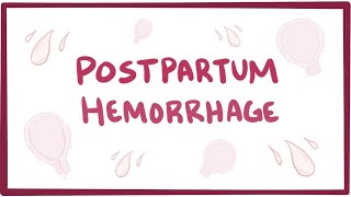 Postpartum hemorrhage - causes, symptoms, diagnosis, treatment, pathology