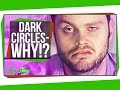 Why Do I Get Dark Circles Under My Eyes