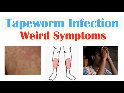 Weird Symptoms of Tapeworm Infection (Skin, Psychological, Neurological)