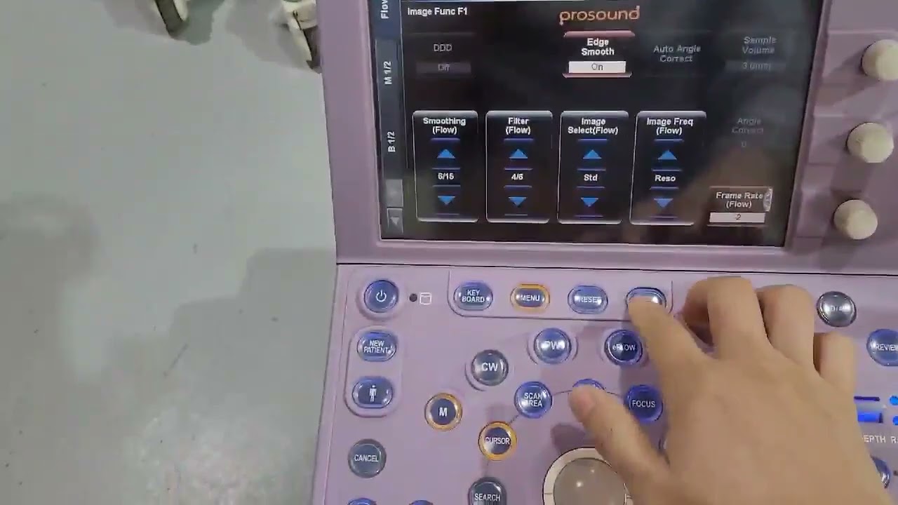 Used Aloka Alpha 6 Ultrasound Test Video