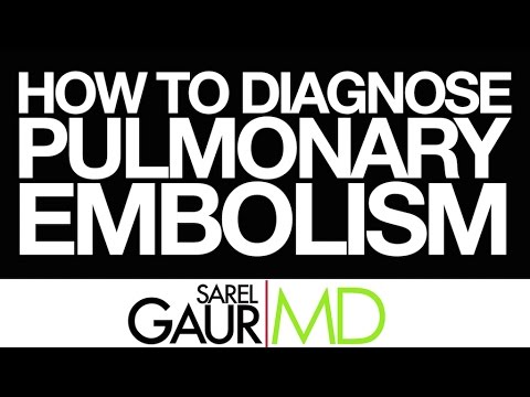 How to Read a CT Pulmonary Angiogram Part II:  How to Diagnose a Pulmonary Embolism