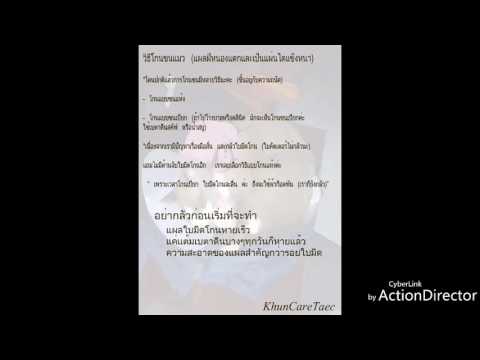 คลิกเพื่อดูคลิปวิดีโอ