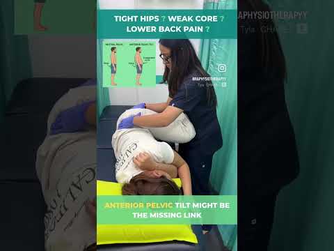 Lower Back Pain May Not Be From Back Alone