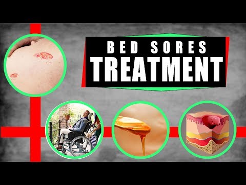 Bed Sores Treatment: How to Treat Bed Sores at Home -...