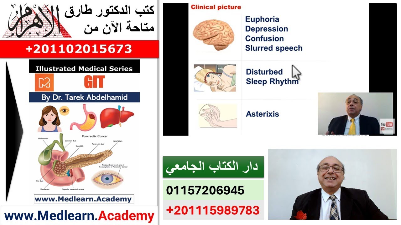 Hepatic Encephalopathy  #internal_medicine #cme #medicaleducation #ecg #محاضرات_باطنة #medical