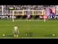 Szalony Rui Patricio