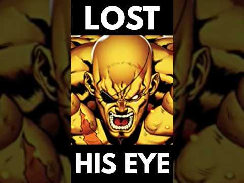 How Sagat Lost His Eye