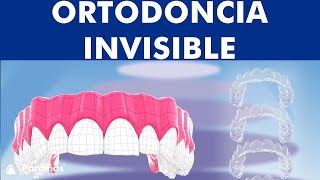 Ortodoncia invisible sin brackets ©