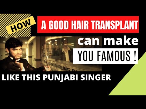 HOW a Good hair transplant can make you a F A M O U S  Punjabi Star | (representative advert story)