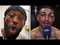 Terence Crawford EXPLODES On Teofimo Lopez For Using N Word Monkey Slur