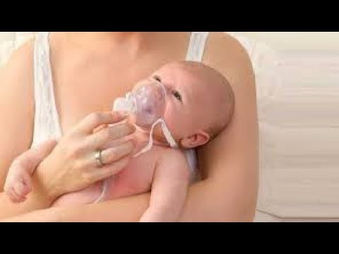 Transient Tachypnea of the Newborn TTN; mild respiratory condition seen in newborns