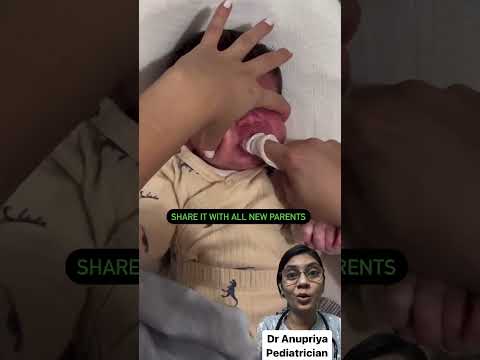 How to clean baby’s oral cavity? #babyshorts #newborn #babycare #babygirl