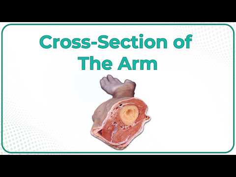 Cross-section of the Arm : Cadaveric Anatomy