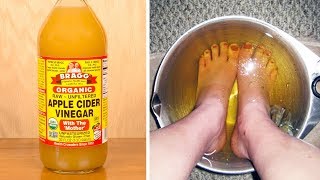 Soak Your Feet In Apple Cider Vinegar For This Incredible Benefits!
