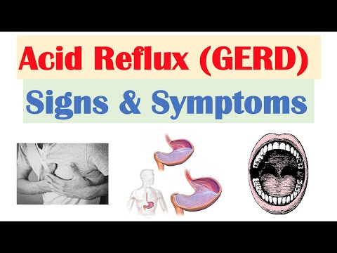 Gastroesophageal Reflux Disease (GERD) Signs & Symptoms (ex. Bad Teeth) | & Why They Occur