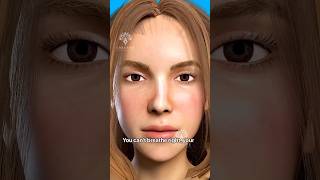 Download lagu How crooked nose corrected - septoplasty surgery works mp3 Download lagu How crooked nose corrected - septoplasty surgery works mp3