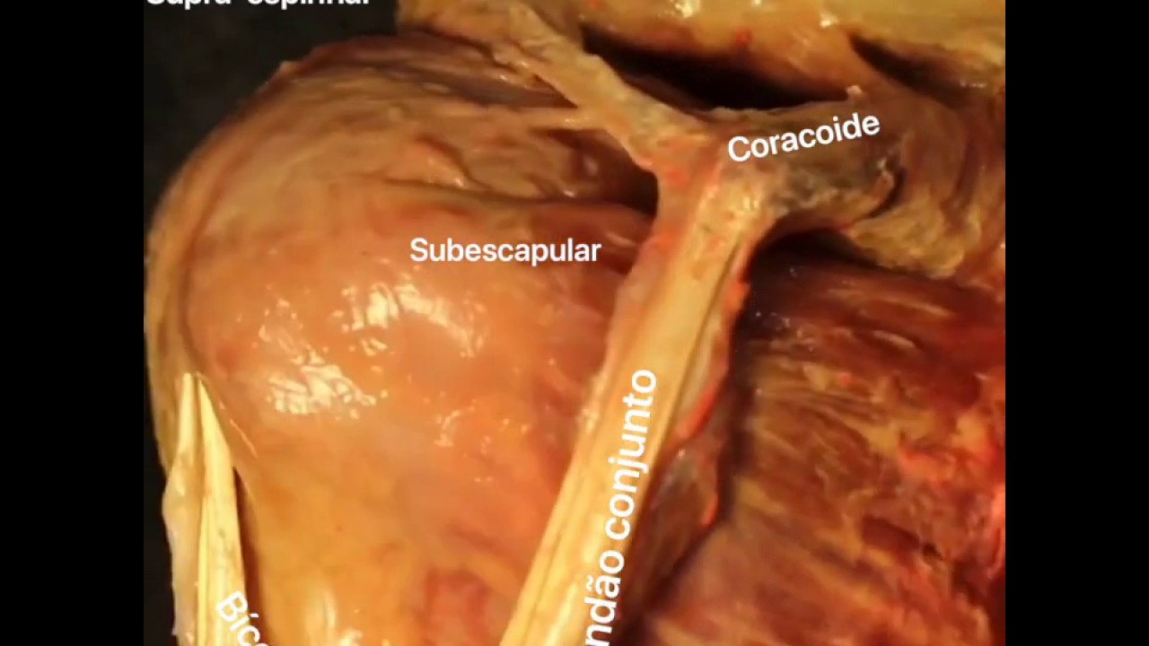 Rafael Patrocinio-17