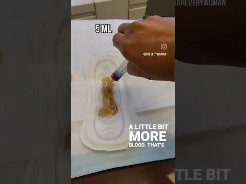 How much is too much period blood loss? #obgyn #menstruation #dreverywoman #period