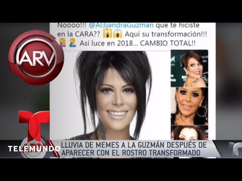 Lluvia de críticas a Alejandra Guzmán por su rostro | Al Rojo Vivo | Telemundo